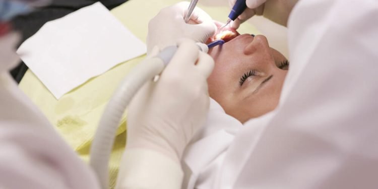 How to Get Affordable All-on-4 Dental Implants in Australia 1