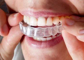 Invisalign_ The Clear Solution for Straightening Teeth