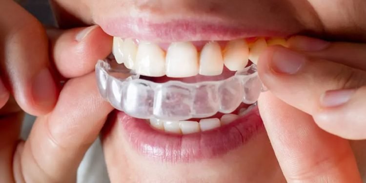 Invisalign_ The Clear Solution for Straightening Teeth