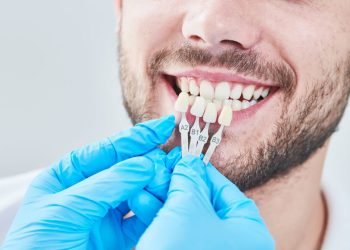 Can You Whiten Porcelain Veneers