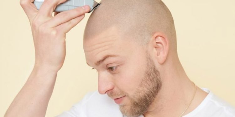 Scalp Micropigmentation