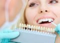 Begin Teeth Whitening