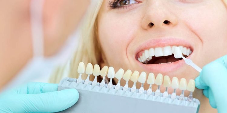 Begin Teeth Whitening