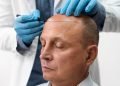 Hair Transplant