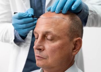 Hair Transplant