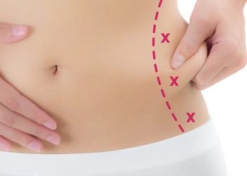 Exploring Body Sculpting and Fat Reduction Techniques
