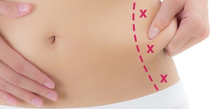 Exploring Body Sculpting and Fat Reduction Techniques