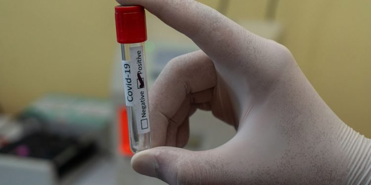 How To Choose The Right Cord Blood Bank For Your Family