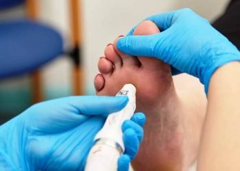 Shouldn't Ignore Verruca Warts