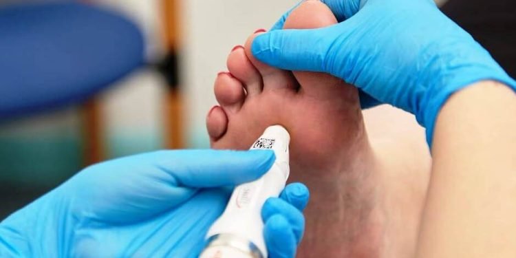 Shouldn't Ignore Verruca Warts