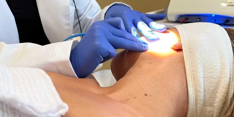 Electrolysis-hair-removal