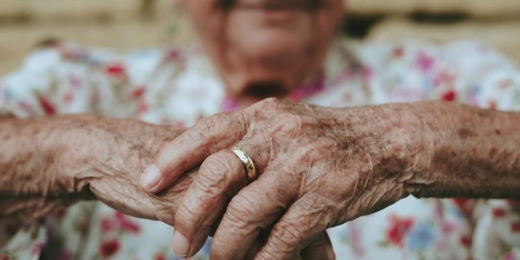 Living Beyond Psoriasis