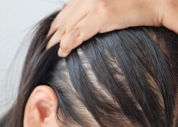 7 Home Remedies to Make Your Hair Thicker
