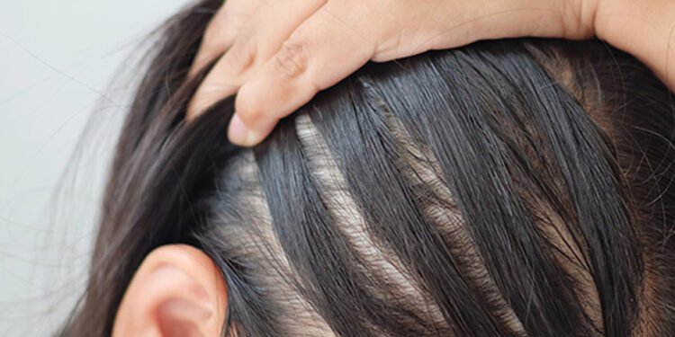 7 Home Remedies to Make Your Hair Thicker
