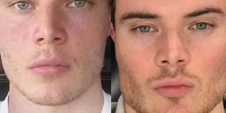 Should-Teenagers-Try-Mewing