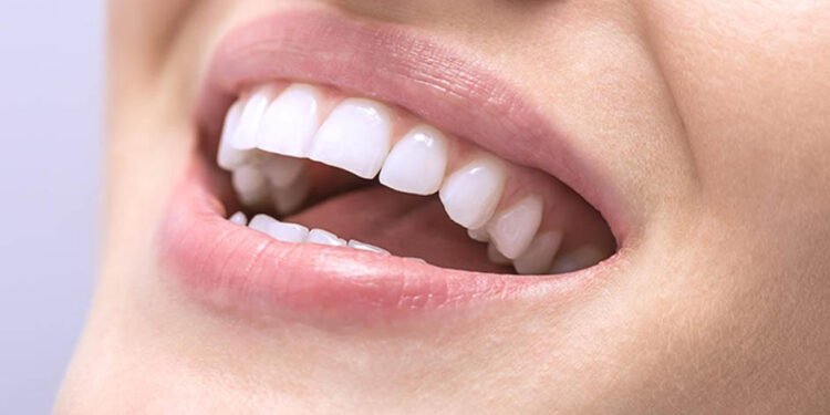 Philips Zoom Teeth Whitening