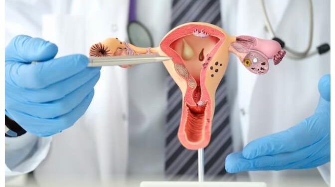 How to Cope With Chronic Pain After Surgery