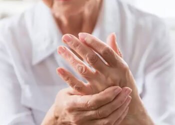 Living with Arthritis