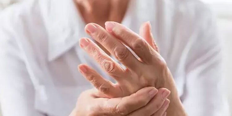 Living with Arthritis