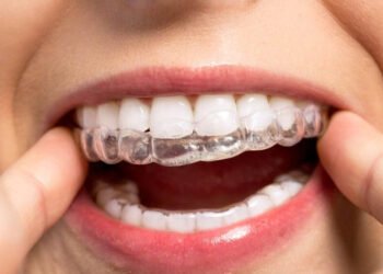 Navigating Invisalign Costs in Winnipeg