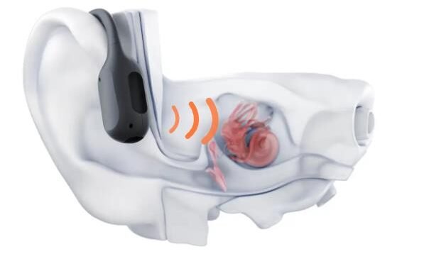 The Inner Workings of Bone Conduction Headphones