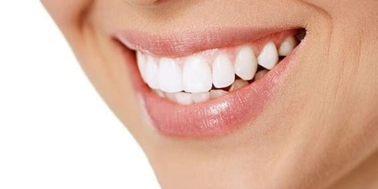 Invisible Braces in Bossier City