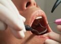Exploring-the-Essentials-of-General-Dentistry