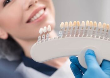 From Veneers to Bonding