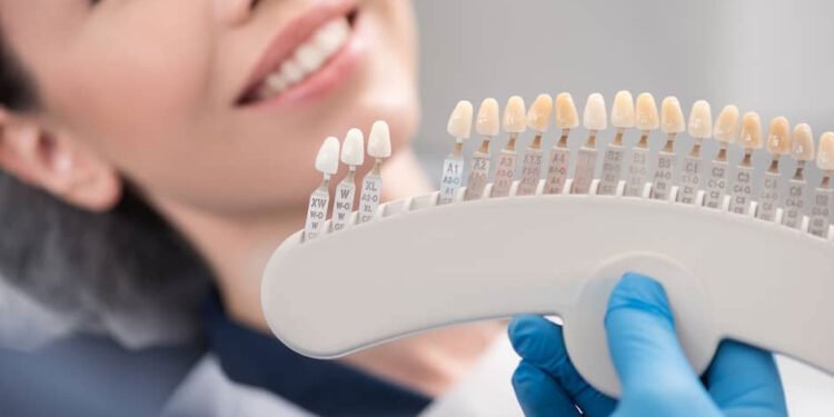 From Veneers to Bonding