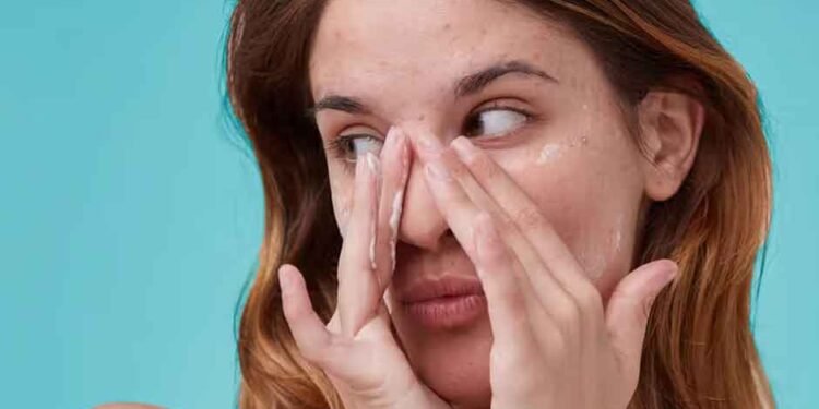 Is Your Facial Cleanser Breaking You Out