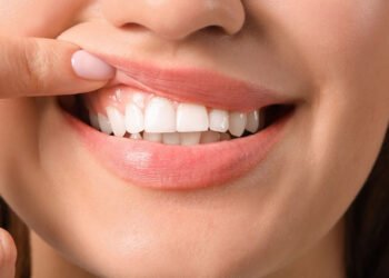 The Importance of Nice Teeth for Overall Health