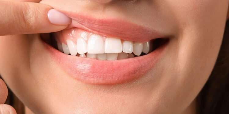 The Importance of Nice Teeth for Overall Health