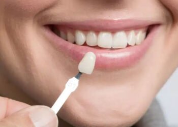 Transform Your Smile