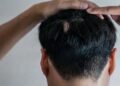 Trichotillomania Hair Regrowth