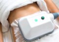 CoolSculpting