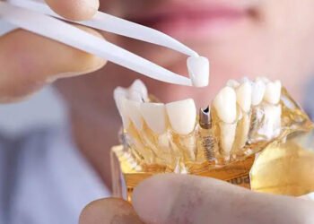 Dental Implants Are Revolutionizing
