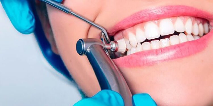 Dental Services for Dentists