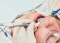 Preparing for Wisdom Teeth Removal_ What to Expect Before, During, and After Surgery
