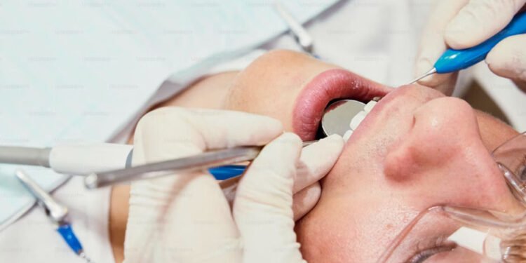 Preparing for Wisdom Teeth Removal_ What to Expect Before, During, and After Surgery
