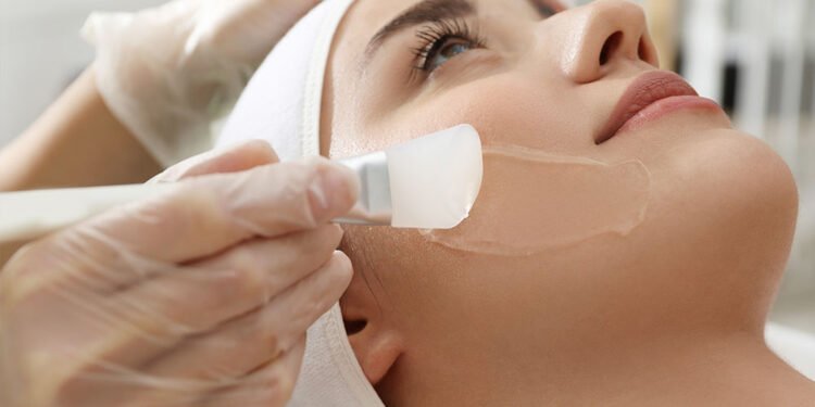 The Art of Chemical Peels- Customized Treatments for Radiant Skin