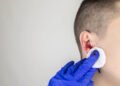 Ear with blood