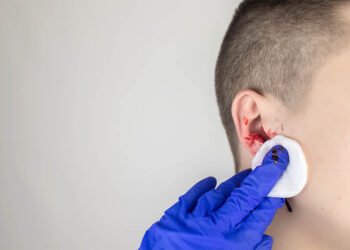 Ear with blood