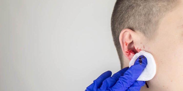 Ear with blood