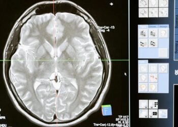 Overcome Anxiety Before Your MRI Scan