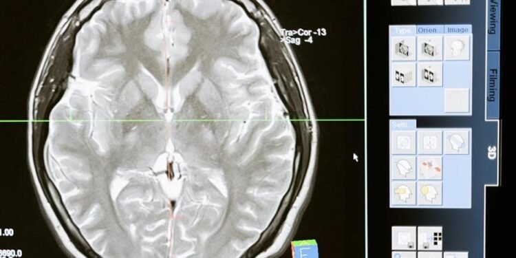 Overcome Anxiety Before Your MRI Scan