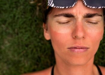 The Science Behind Sun-Induced Wrinkles and Spots