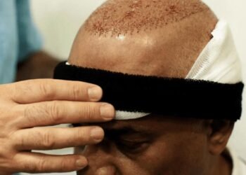 Turkish Hair Transplants