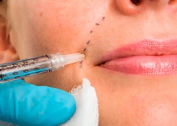 Dermal Fillers