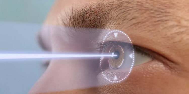 The Benefits of LASIK Surgery
