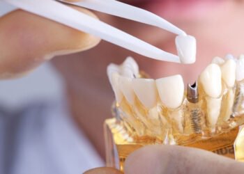 Australians to consider dental implants